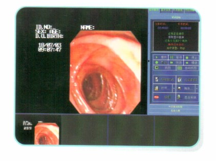 手术显微镜专家视频系统,手术显微镜视频系统