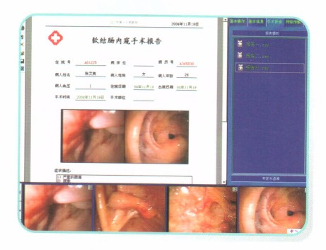 手术显微镜专家视频系统,手术显微镜视频系统