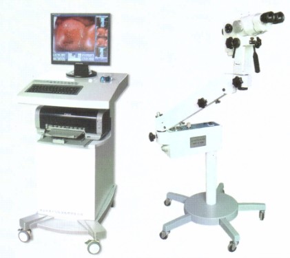 colposcope,Electronic colposcope，photoelectron colposcope,a colposcope