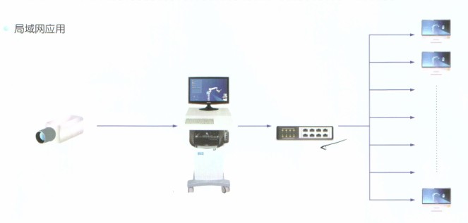 手术显微镜专家视频系统,手术显微镜视频系统