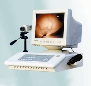 PK-3102 infrared galactophore diagnoses system