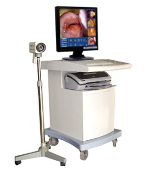 DIGITAL ELECTRONIC COLPOSCOPE (Gynecology , Optical colposcope,colposcopic,a colposcopy,colposcopy,vaginoscopevaginal speculum) surgical (Surgery,Operation,operating,OPS) microscope